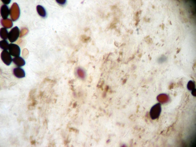 Pigmento_intracelular_trama_himenio__650_x_488_.jpg