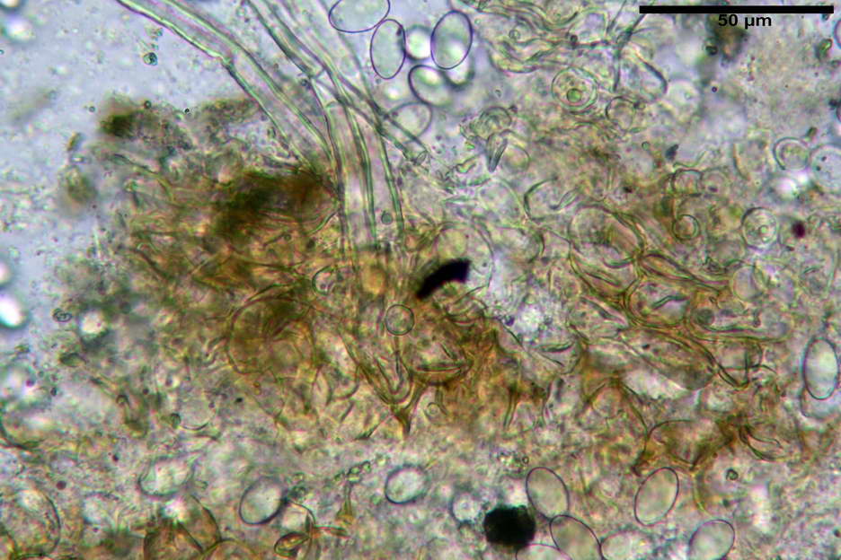 tricharina gilva 4831 14.jpg