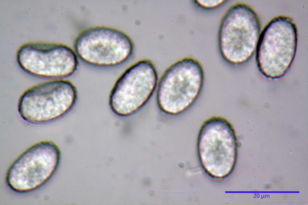 scutellinia 57.jpg