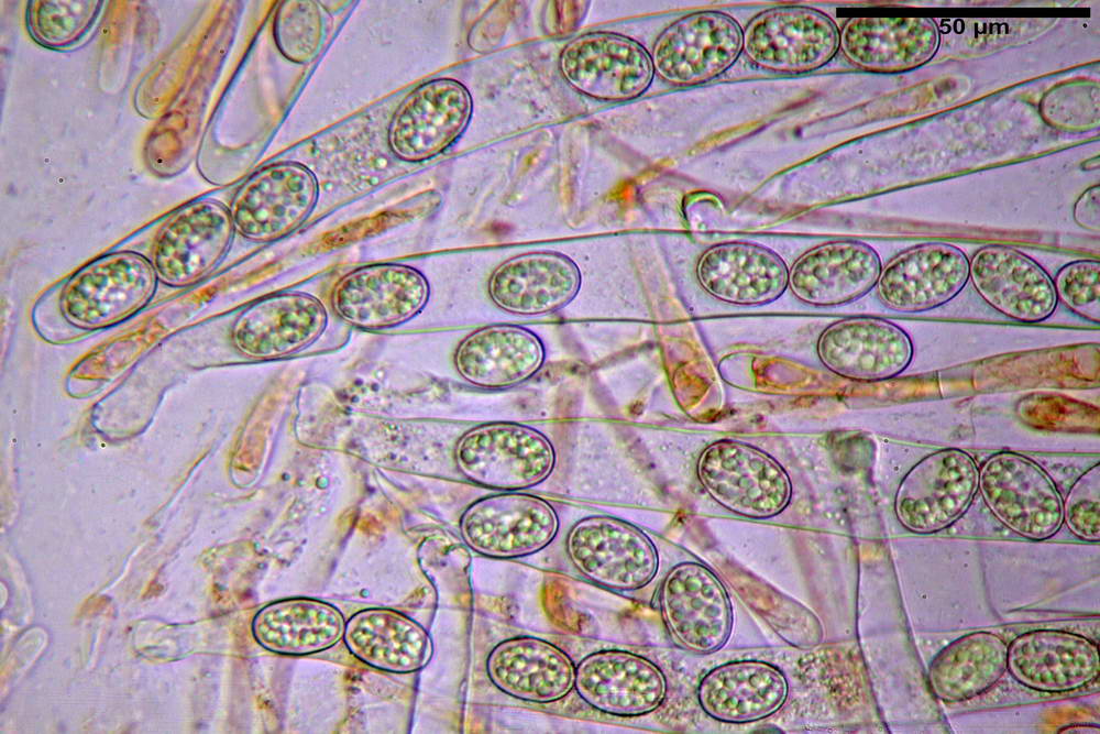 scutellinia crinita 28.jpg