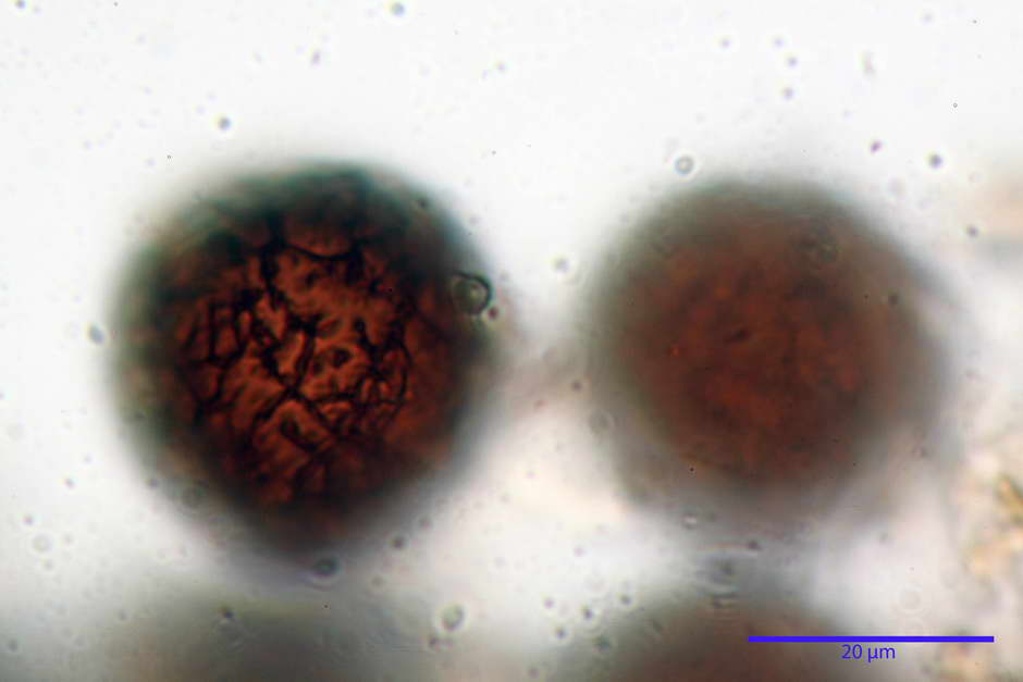 elaphomyces granulatus 4710 21.jpg