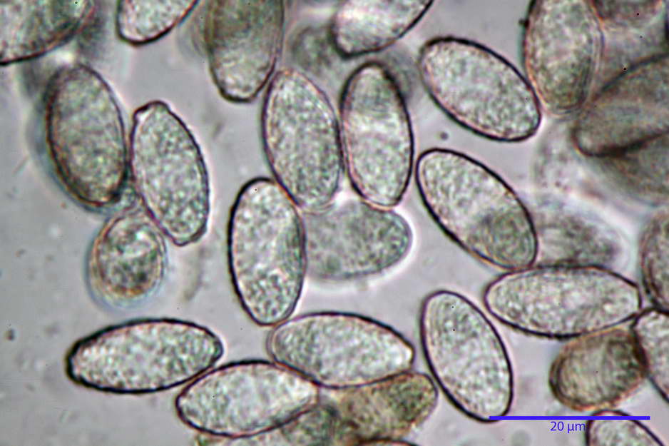 peziza badioides 4670 47.jpg