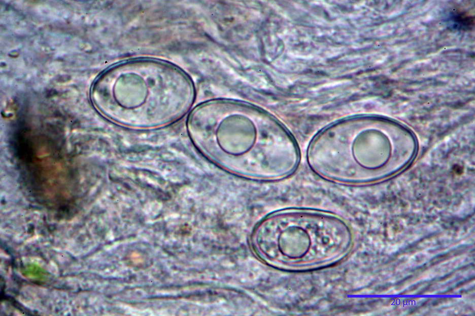 octospora roxheimii 4825 25.jpg