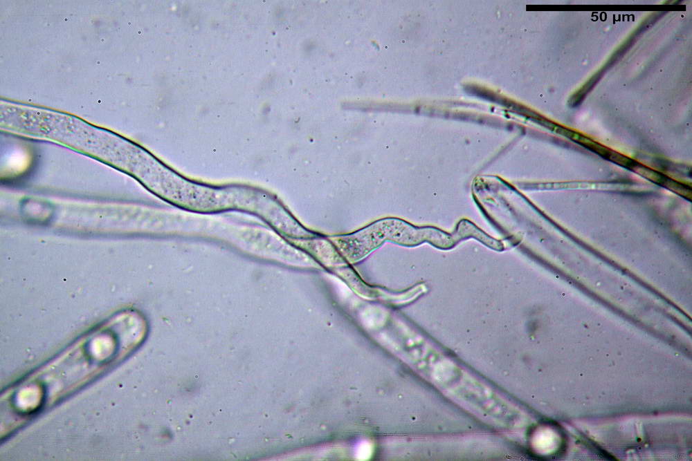 pseudoplectania nigrella 5040 04.jpg