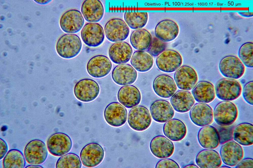 pilobolus crystallinus var hyalosporus.jpg
