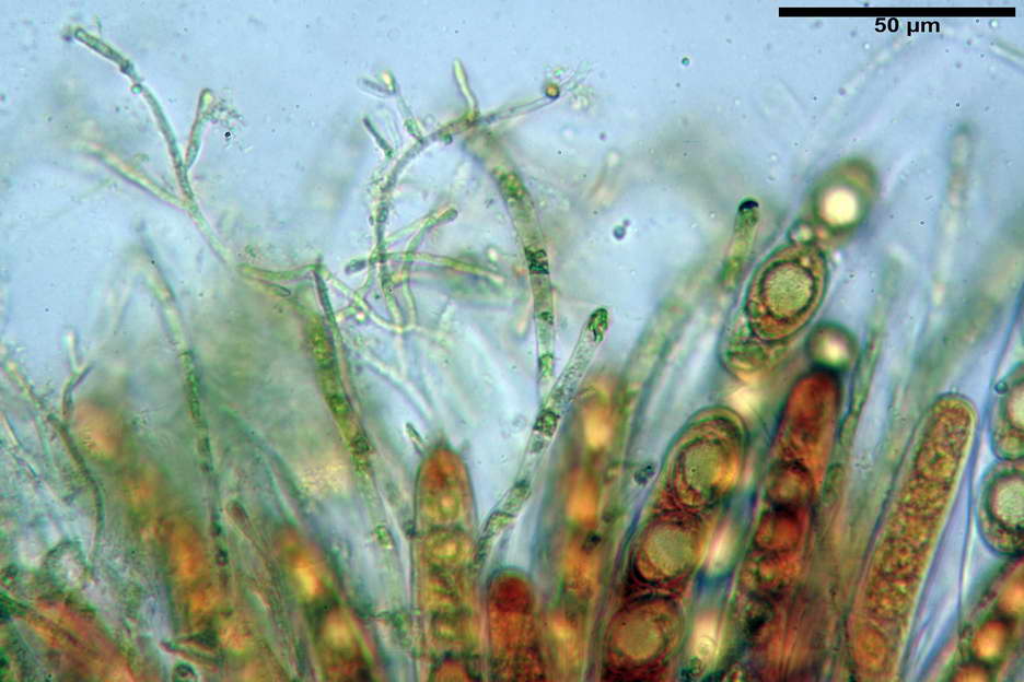 octospora roxheimii 4825 19.jpg