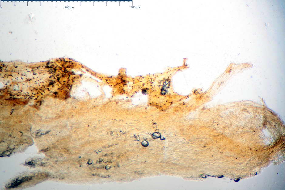 lacrymaria pyrotricha 4812 03.jpg