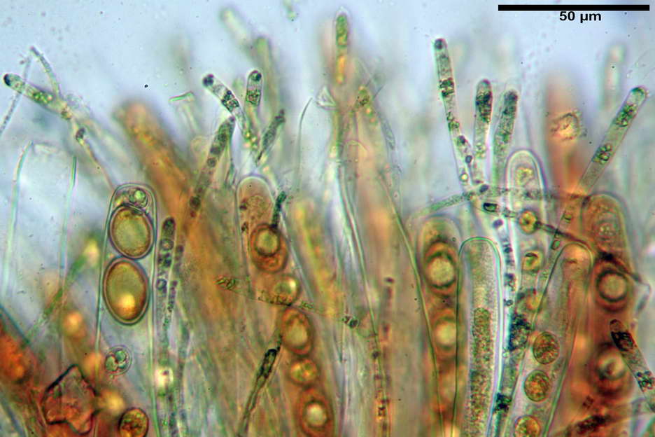 octospora roxheimii 4825 18.jpg