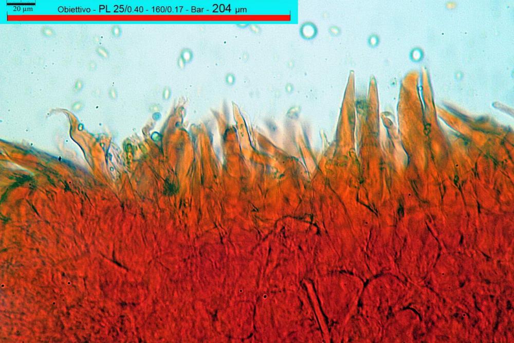 macrocystidia cucumis pileipellis e pileocistidi.jpg