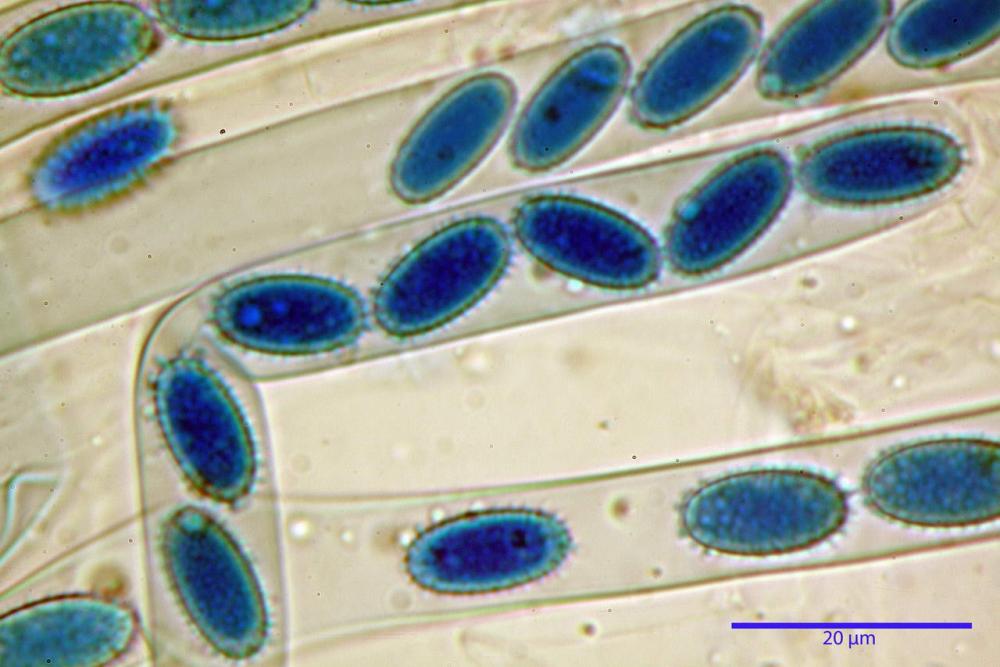 9 peziza echinospora blu lattico a caldo1.jpg