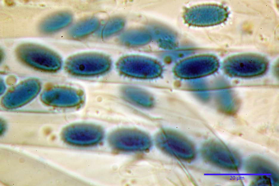 peziza echinospora 4826 71.jpg