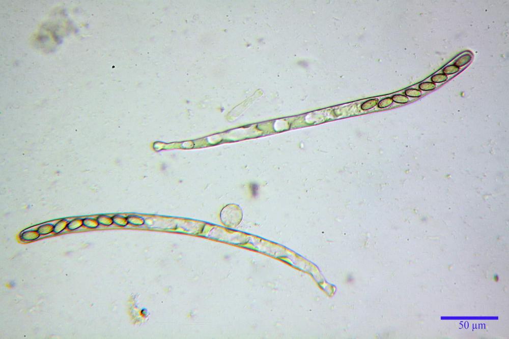 5 peziza echinospora aschi.jpg