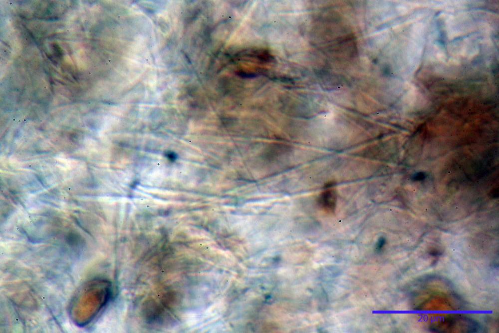 Conocybe macrocephala cristalli di ossalato di calcio KOH .jpg