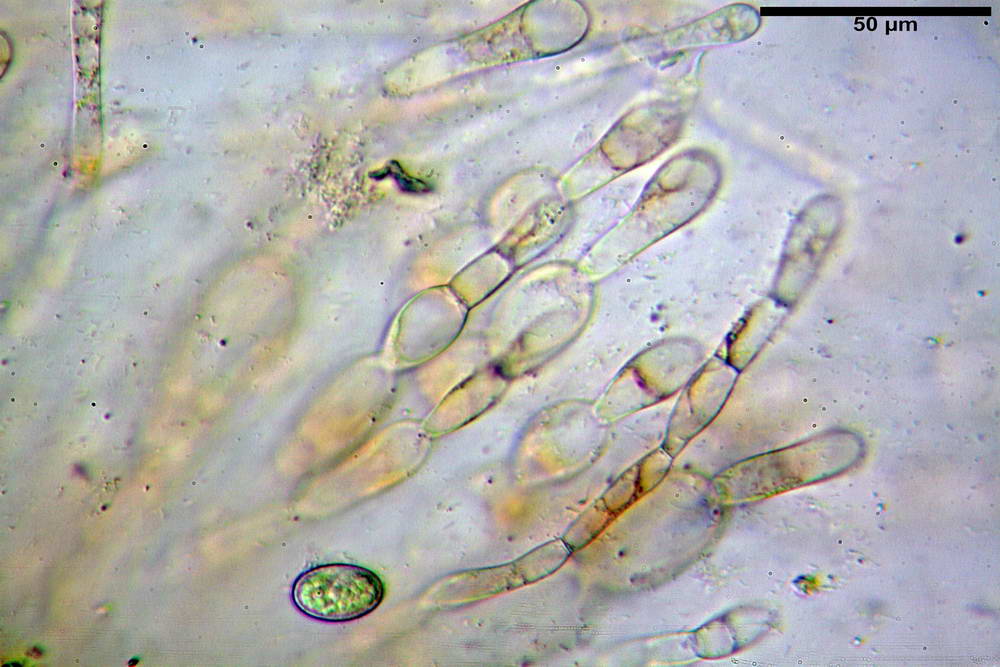 scutellinia crinita 23.jpg