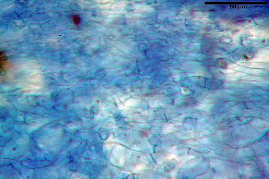 peziza subviolacea 4827 12.jpg