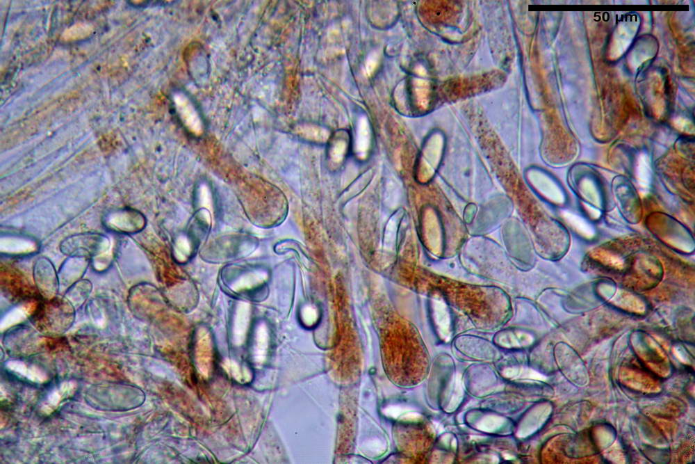 cheilimenia granulata 0013 .jpg