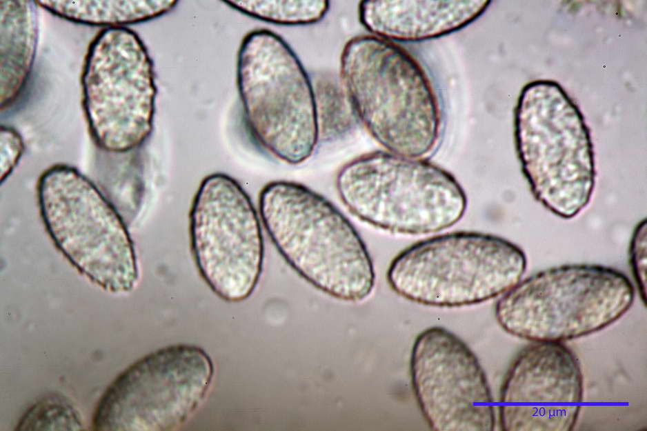 peziza badioides 4670 50.jpg