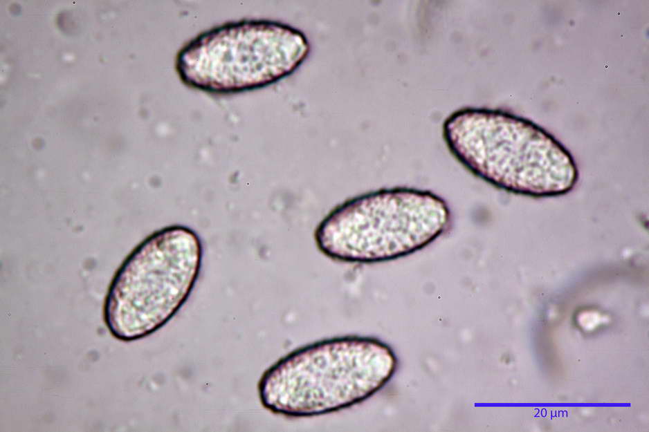 peziza badioides 4670 46.jpg