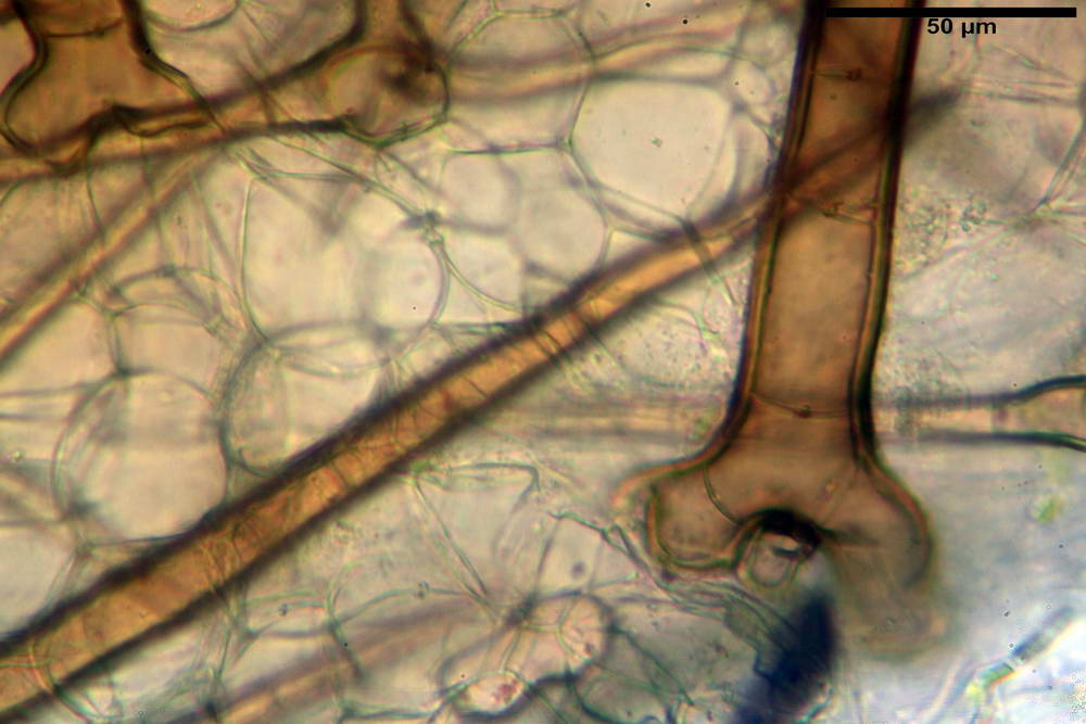 cheilimenia stercorea 4900 27.jpg
