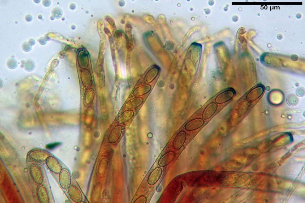 6 peziza echinospora aschi e parafisi, melzer.jpg