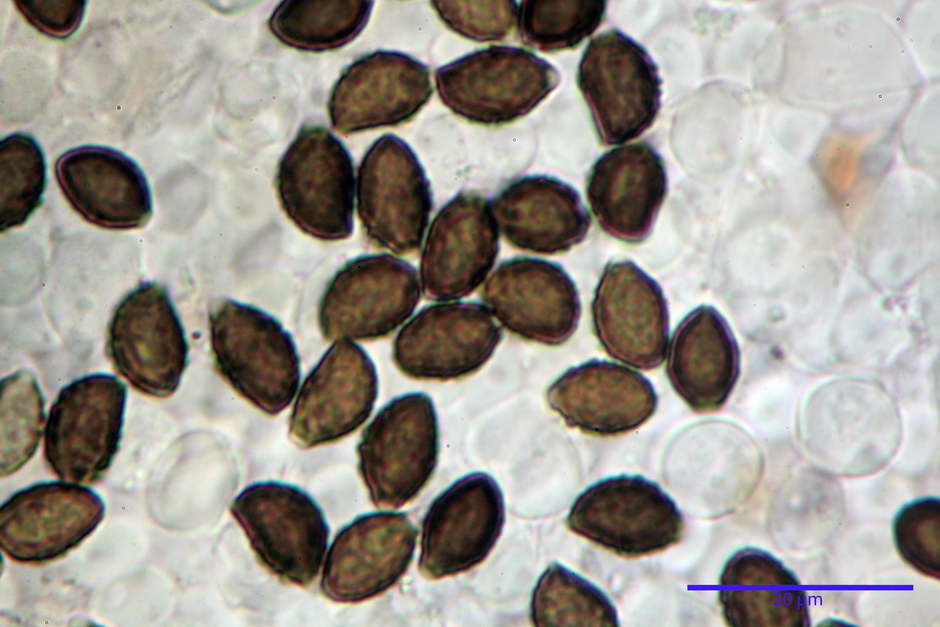 lacrymaria pyrotricha 4812 61.jpg
