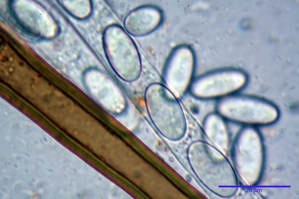 cheilimenia stercorea 4900 53.jpg