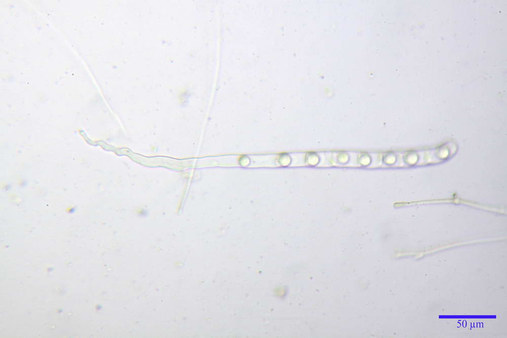 pseudoplectania nigrella 5040 03.jpg