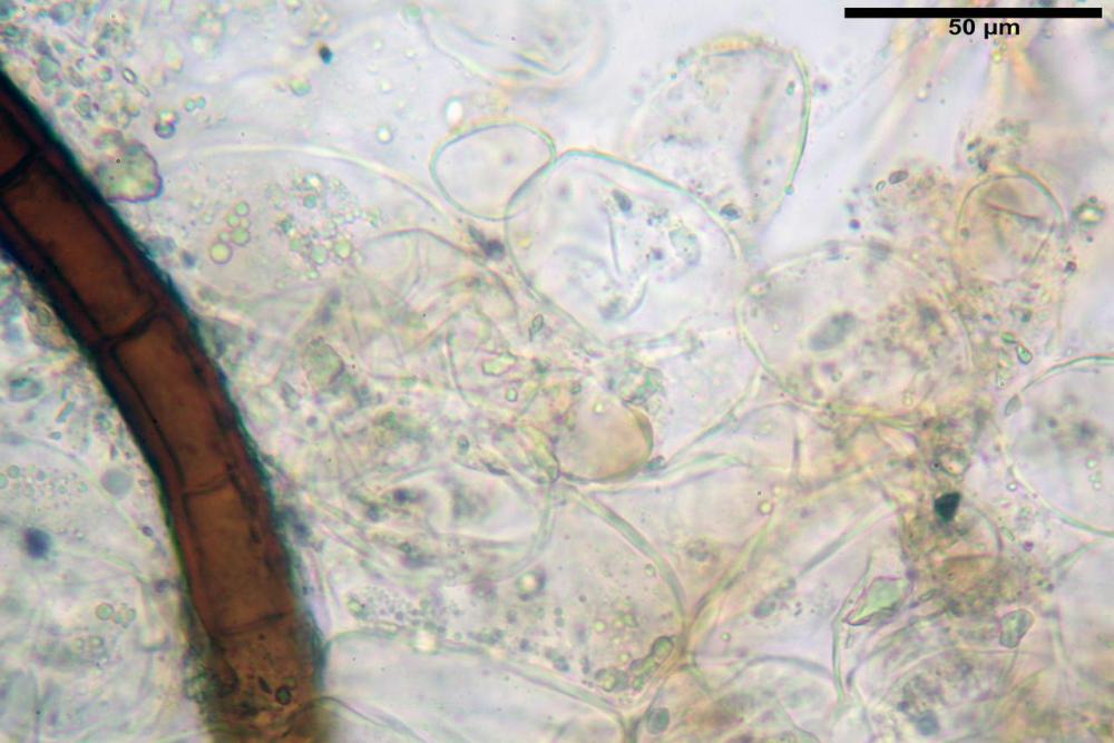 Scutellinia subhirtella 7482 30.jpg