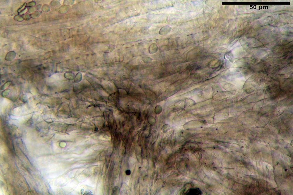 Pileipellis olivascens 5843 secco KOH 2%.JPG