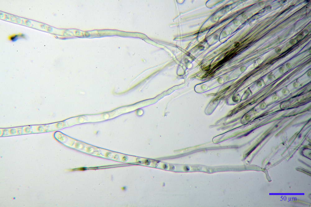 pseudoplectania nigrella 5040 02.jpg
