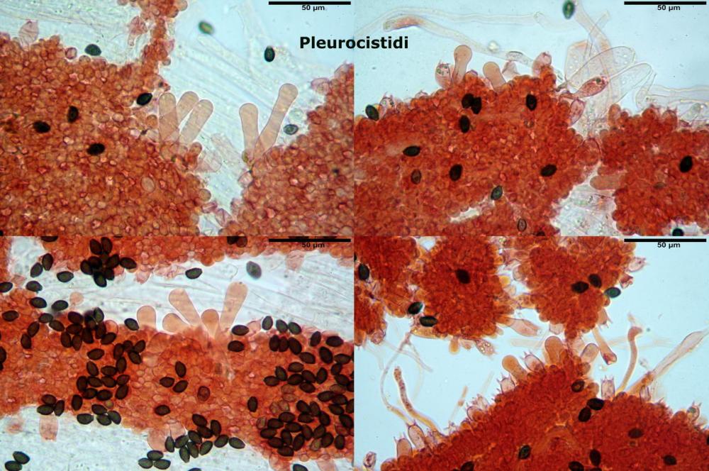 Lacrymaria lacrymabunda pleurocistidi.jpg