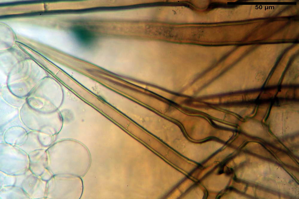 cheilimenia stercorea 4900 24.jpg