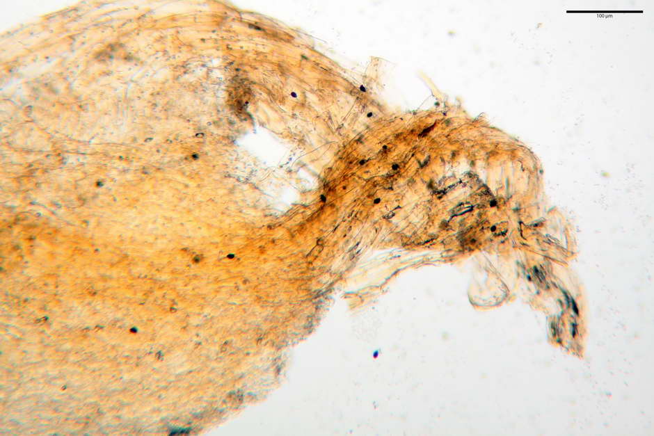 lacrymaria pyrotricha 4812 06.jpg