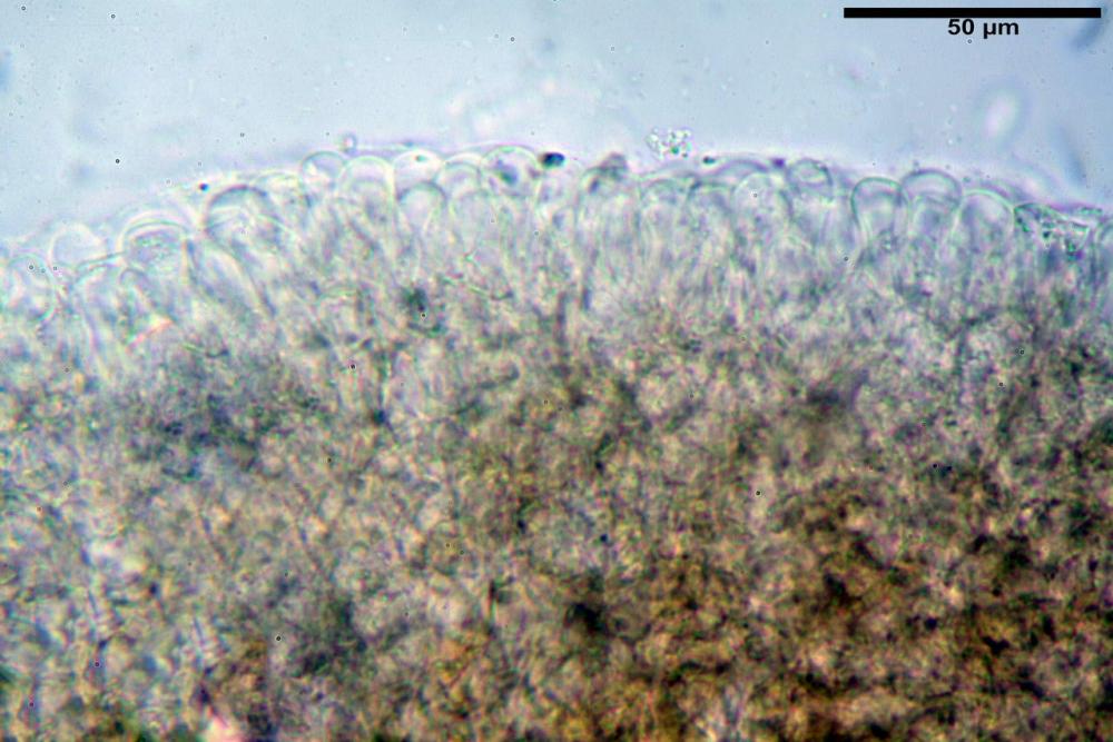 Pholiotina dasypus pileipellis 02.JPG