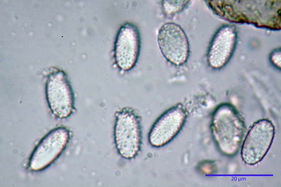 peziza echinospora 4826 66.jpg