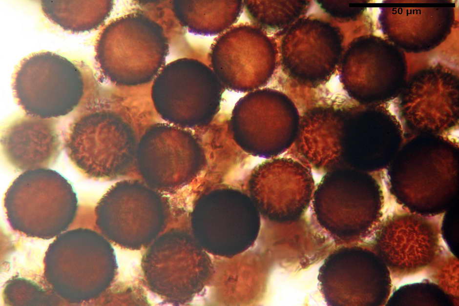 elaphomyces granulatus 4710 13.jpg