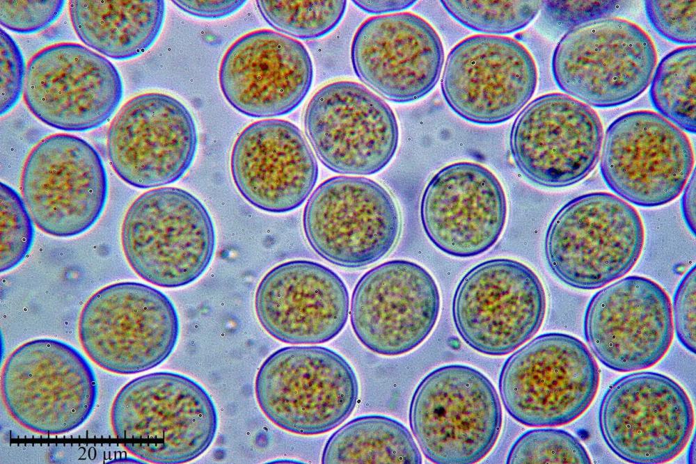 pilobolus oedipus spore.jpg