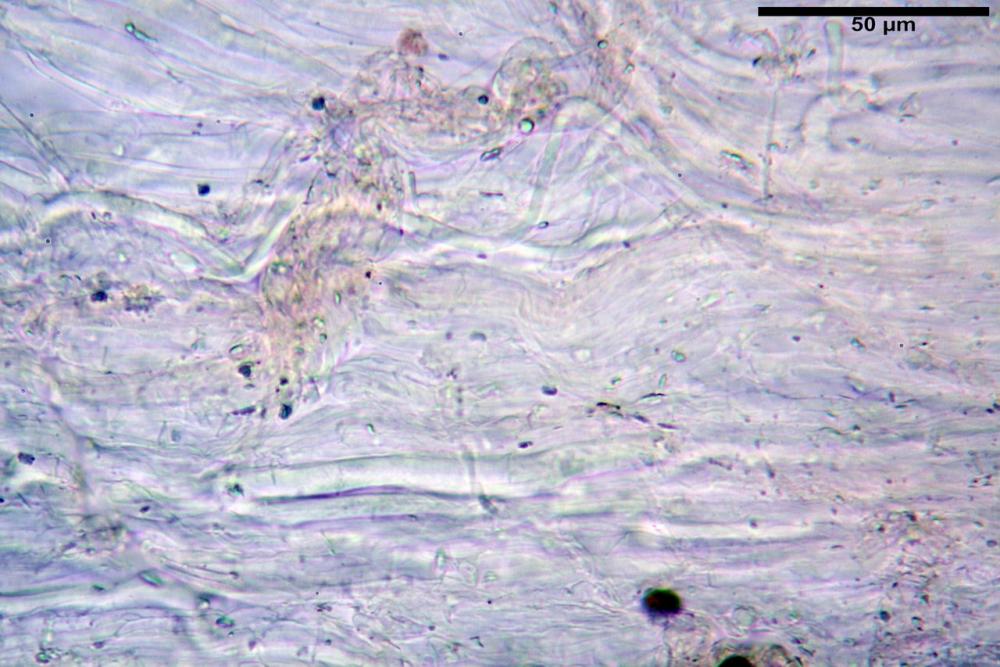 Cystoagaricus silvestris 5336 71.jpg