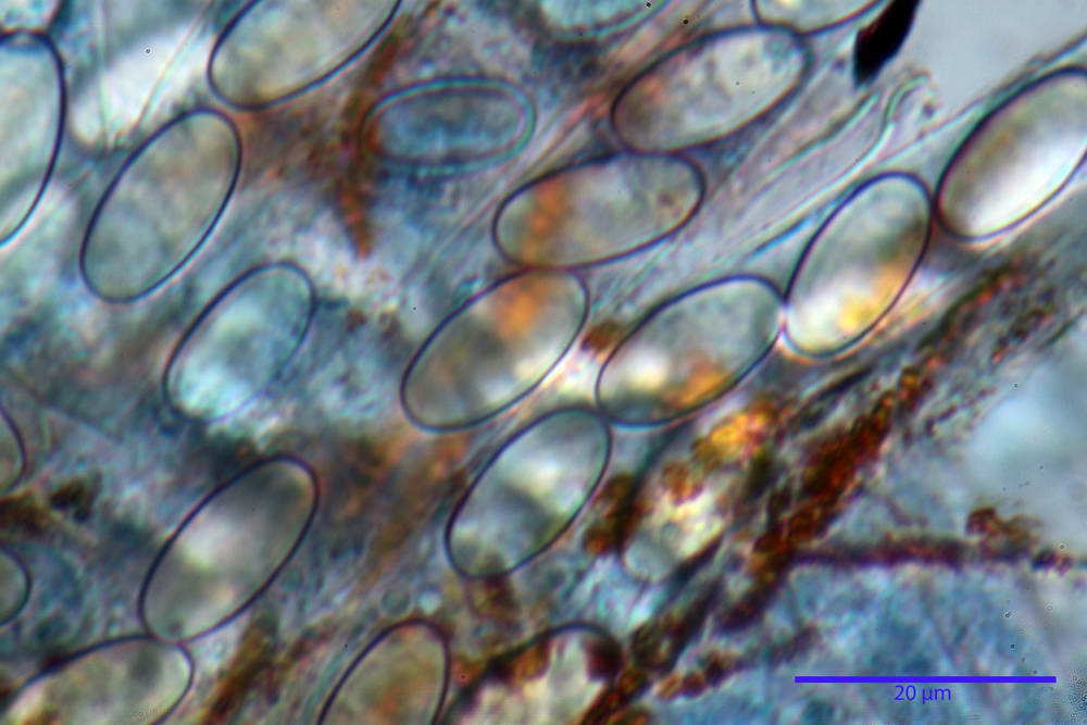 cheilimenia stercorea 4900 59.jpg