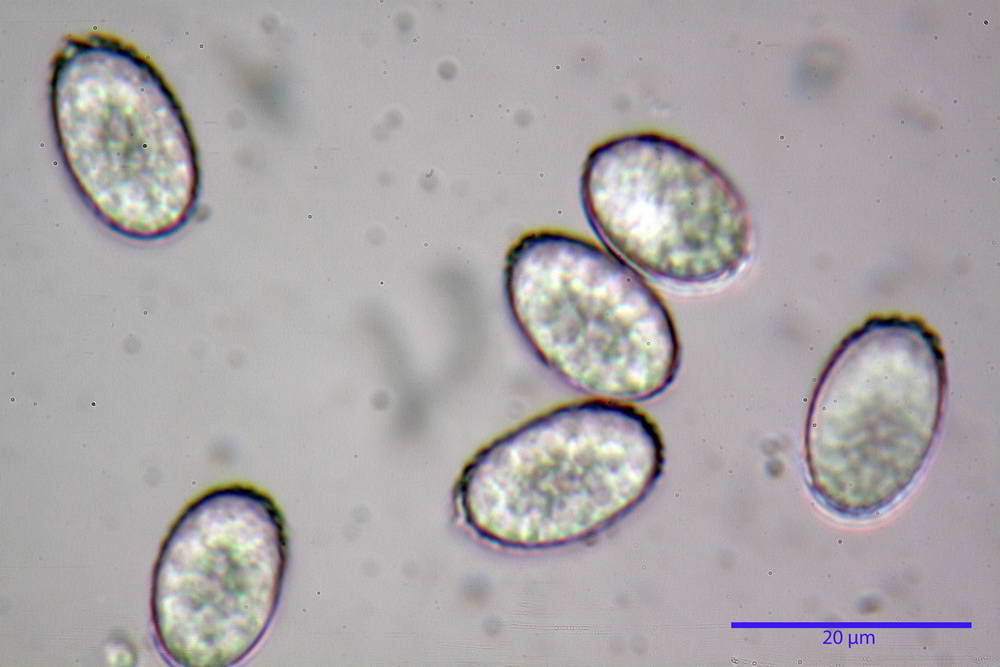 scutellinia 60.jpg