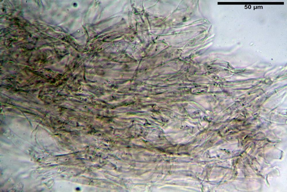 subpellis luteo-olivaceum 5800 secco KOH 2%.jpg