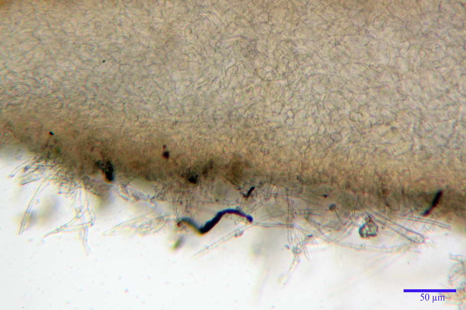 octospora roxheimii 4825 06.jpg