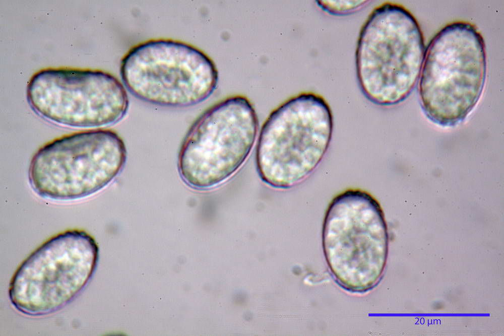scutellinia 58.jpg