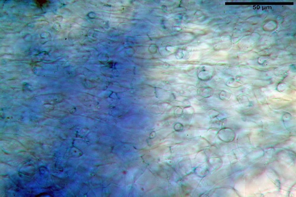 4 peziza subviolacea excipulum medullare medio.jpg