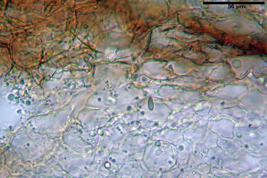 hysterangium 05.jpg