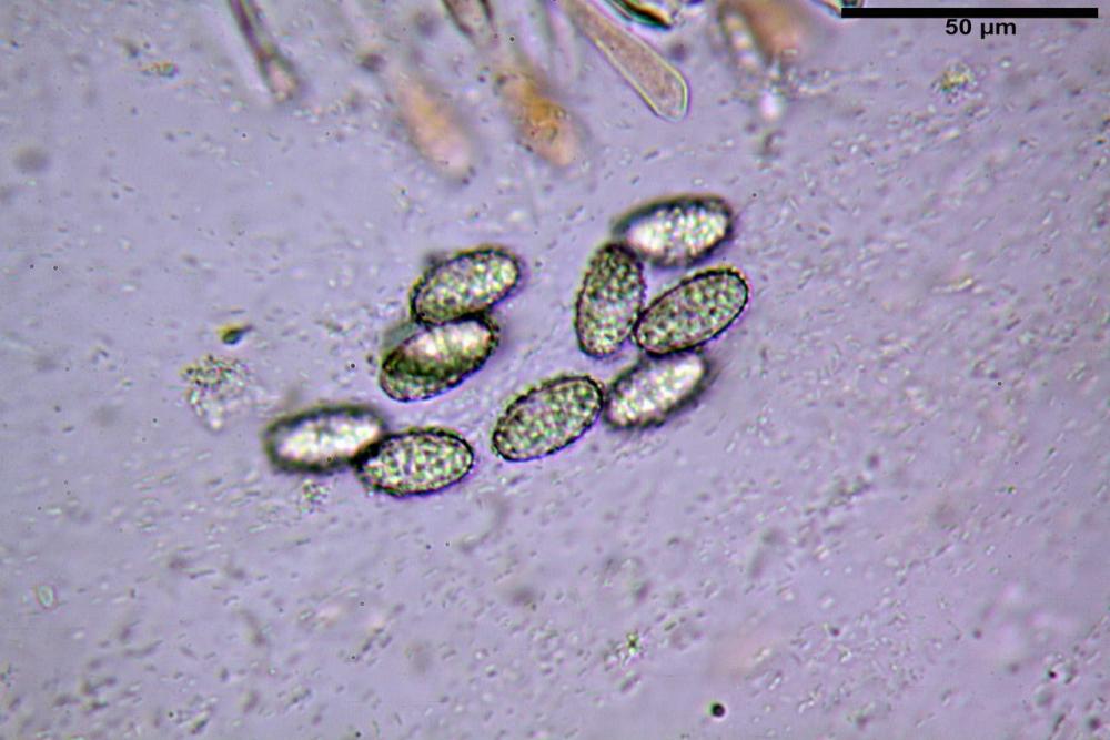 Scutellinia cejpii 079.jpg