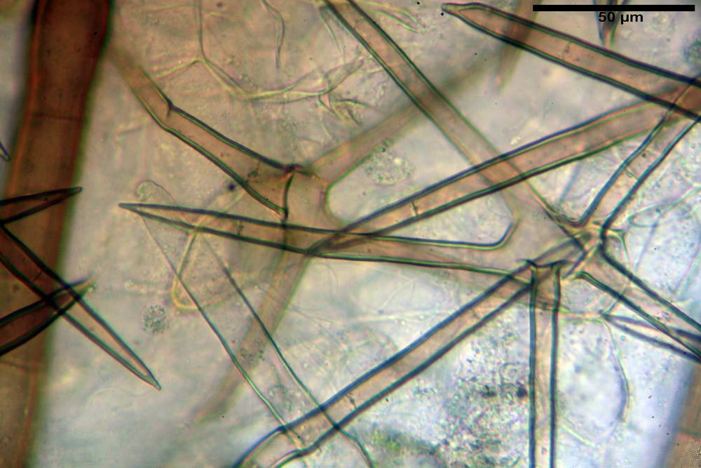 cheilimenia stercorea 4900 26.jpg