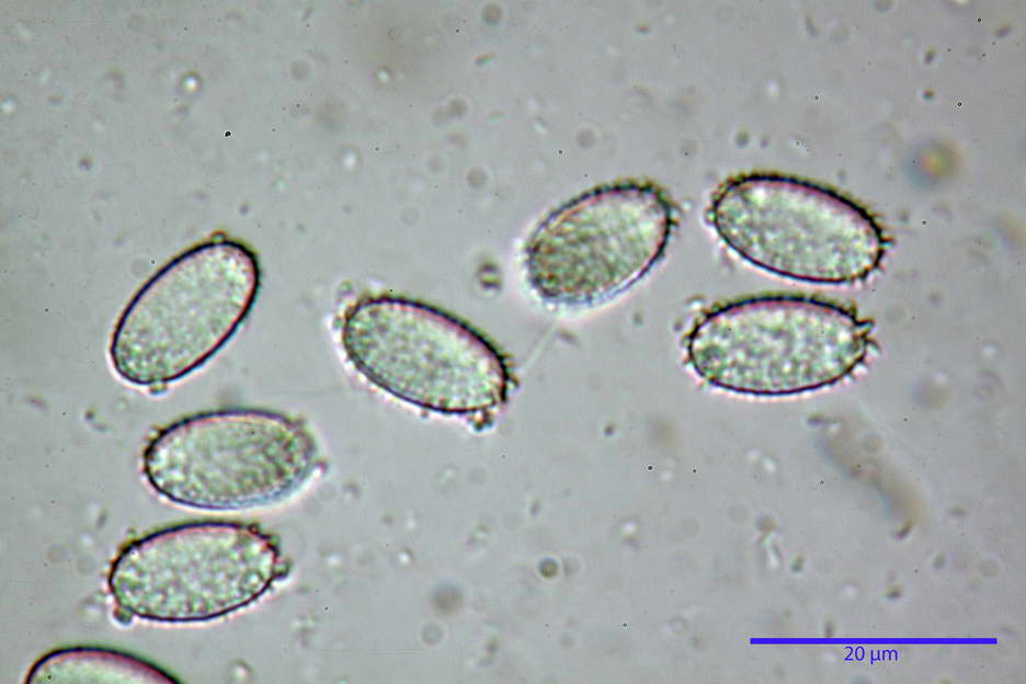 peziza echinospora 4826 63.jpg