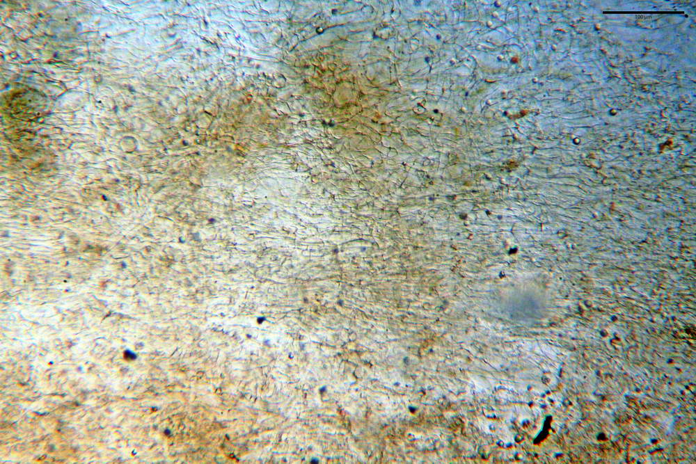 plicaria endocarpoides 5034 10.jpg