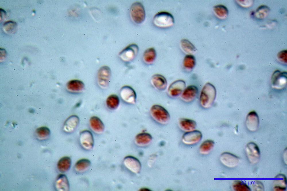 spore luteo-olivaceum 5800 secco rosso congo amm 2%.JPG